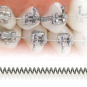 open-coil